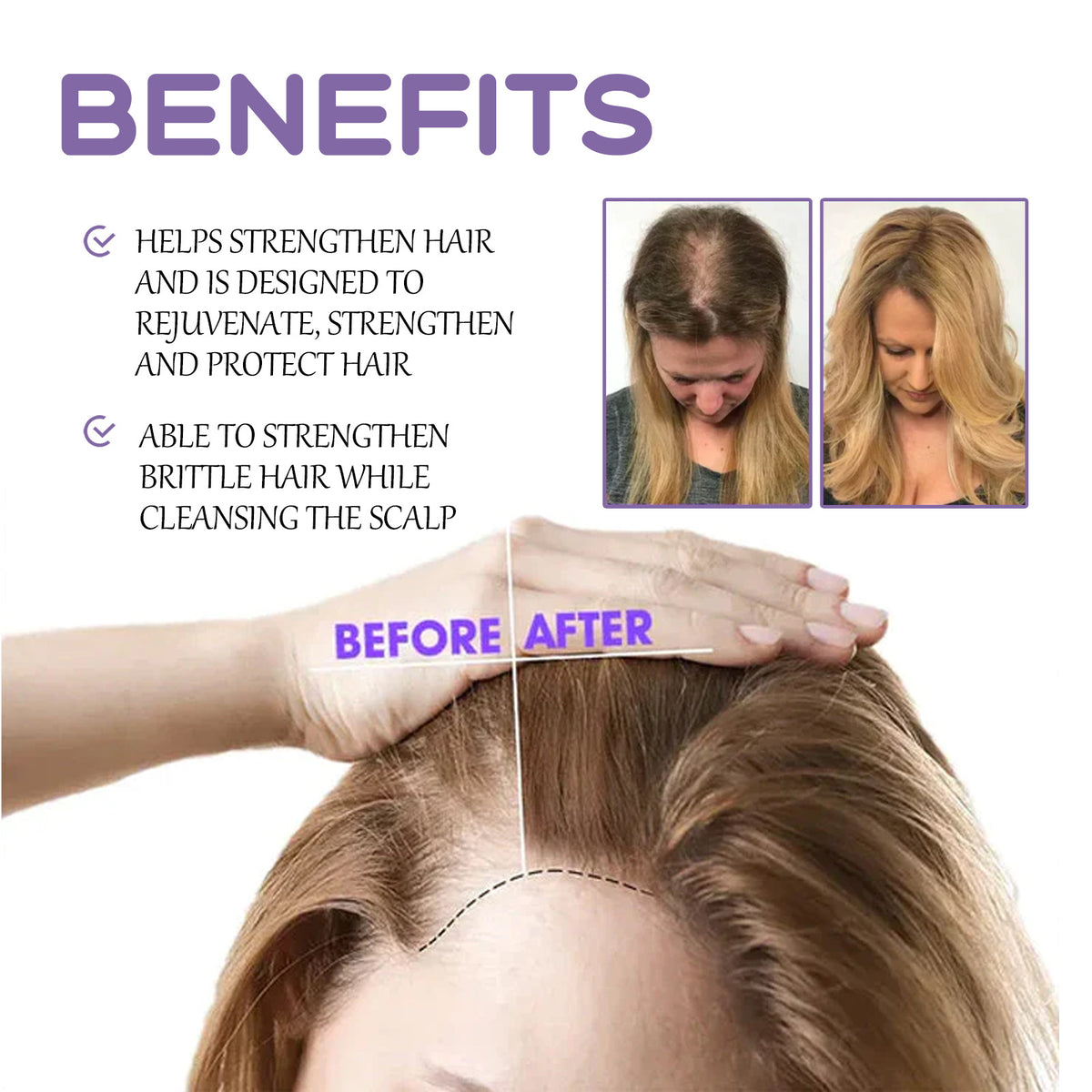 Sérum para Crecimiento Capilar – Antic aída y Engrosador de Cabello
